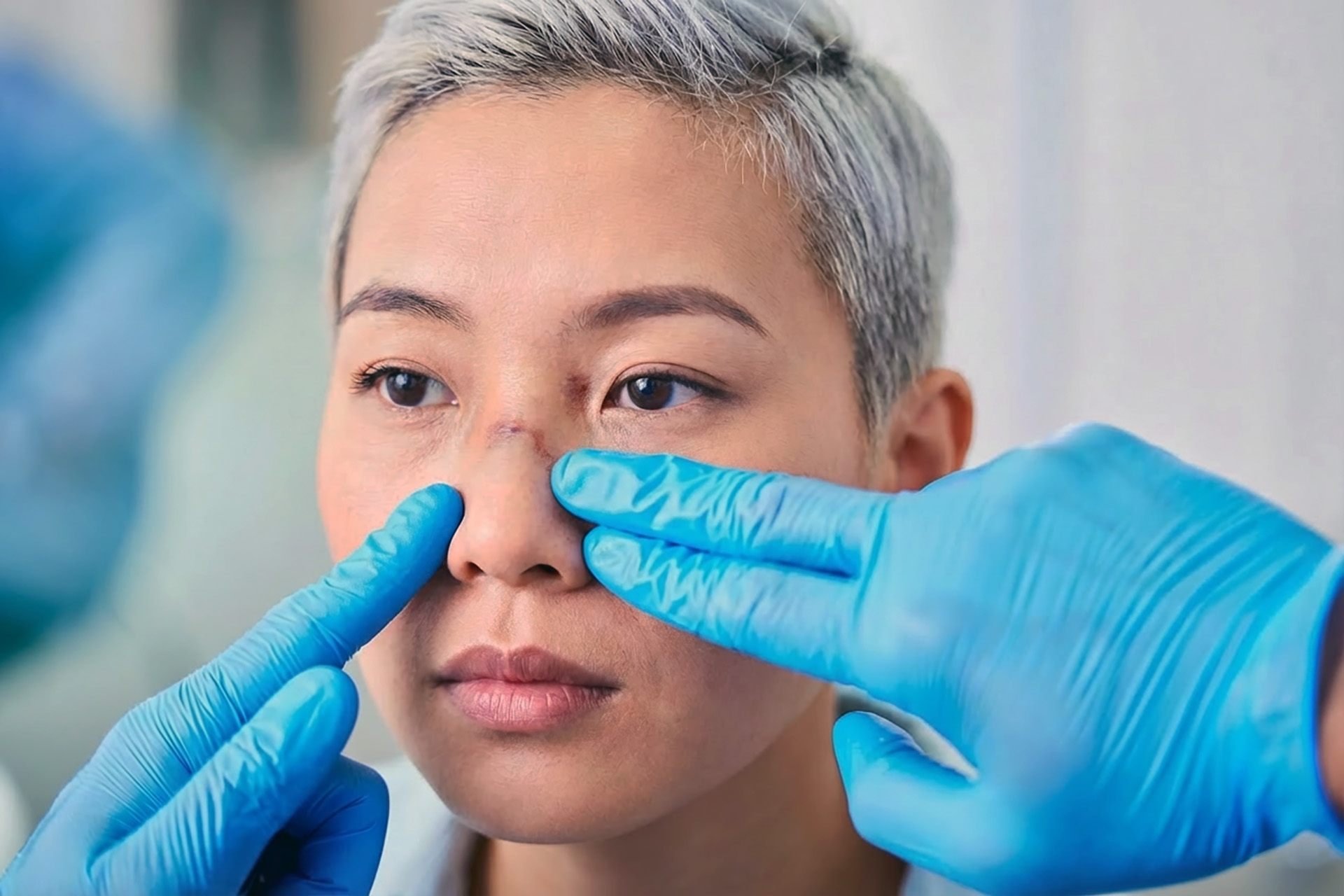 otolaryngology clinic closed nasal fracture reduction